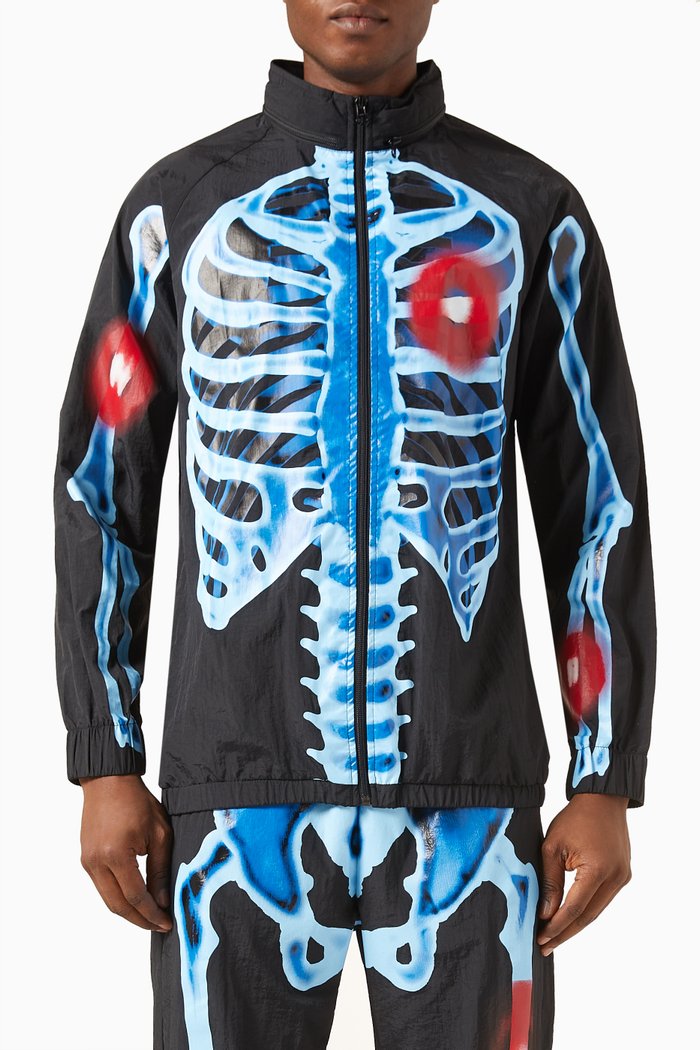 

Injuries Track Jacket, Multicolour